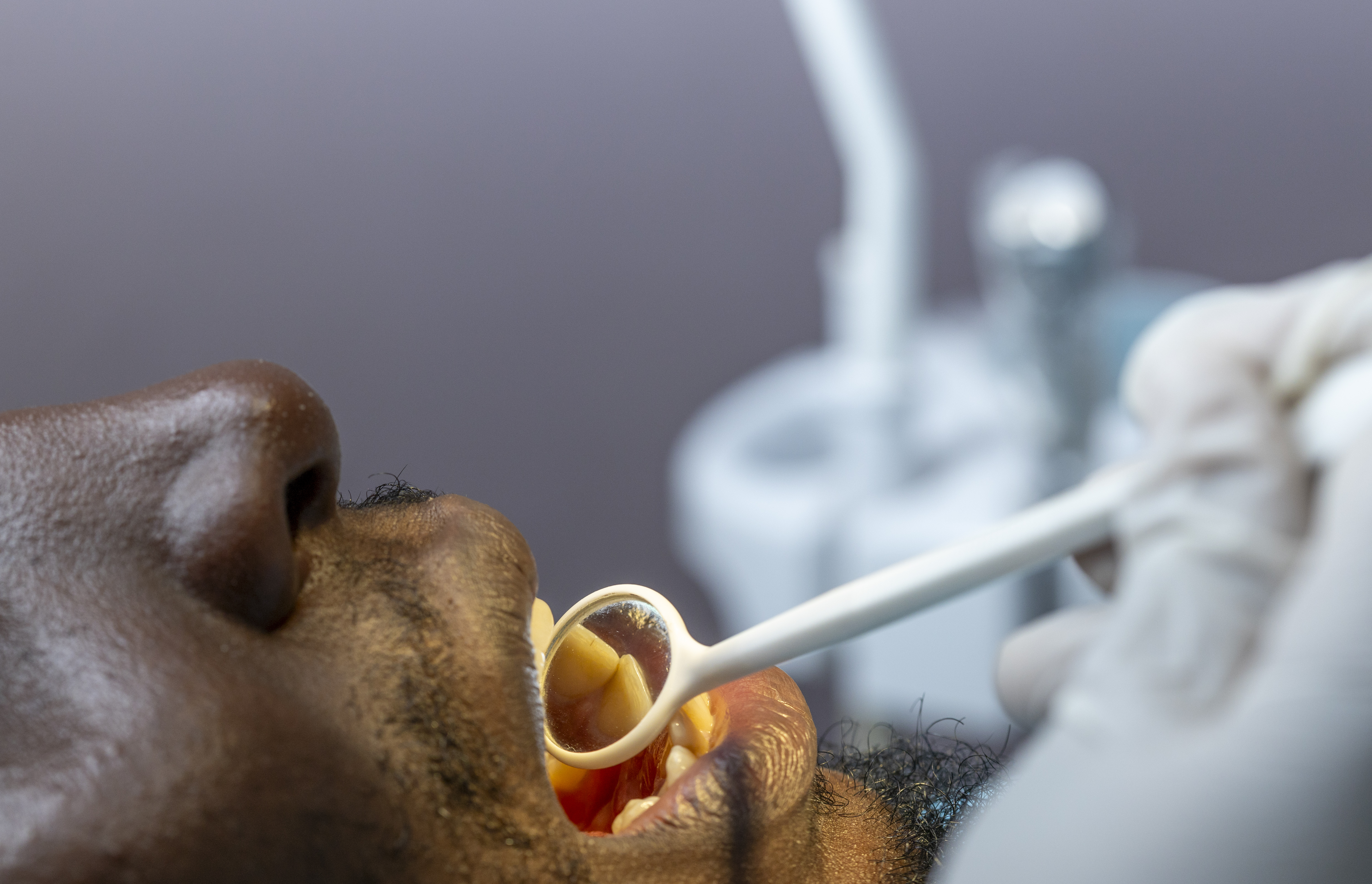 Implanturile dentare în România: cum planifică românii din Germania tratamentul pentru costuri reduse