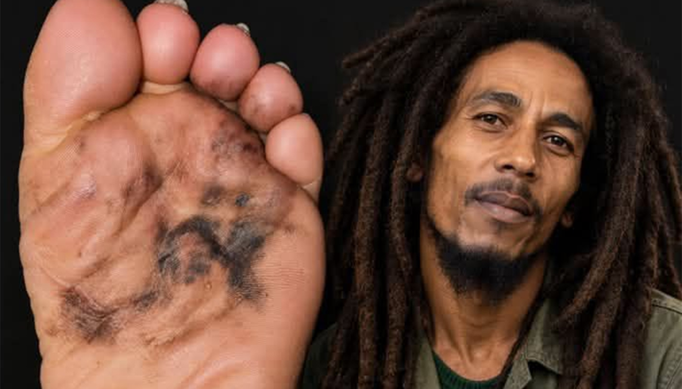 Povestea tragică din spatele morții lui Bob Marley: un cancer ascuns sub unghia de la picior